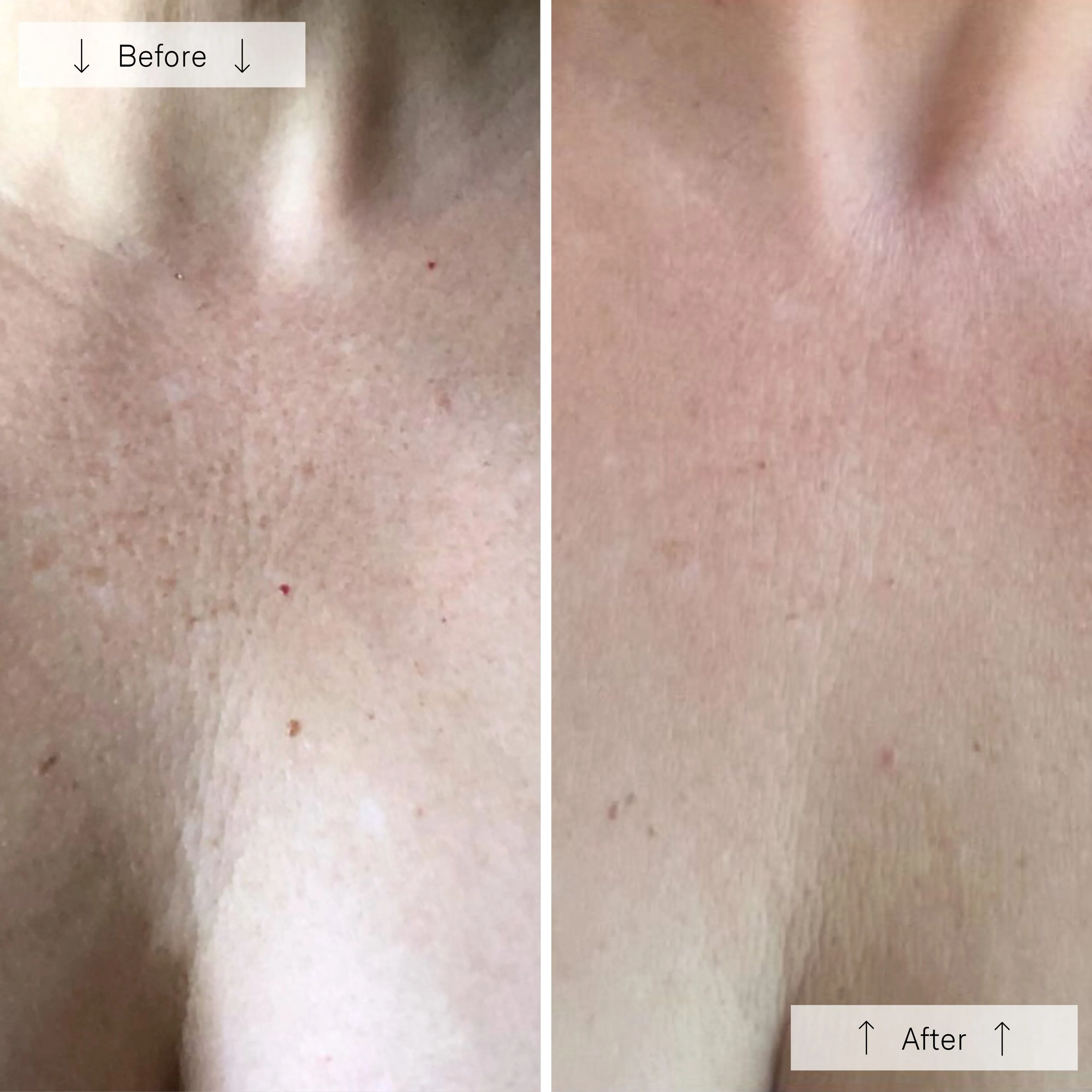 OmniLux Contour LED Mask Neck & Décolleté - Image 7